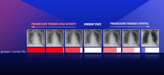 series of images depicting the progression of a patient (current state) diagnosed with COVID-19