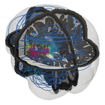 translucent rendering of a brain with electrical field represented by colorful lines (magnetic field streamlines) coming out of a central source; cross-sections of the brain shown in black and gray