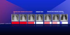 series of images depicting the progression of a patient (current state) diagnosed with COVID-19