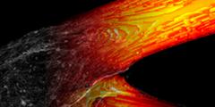 visualization of blood flow in a blood vessel