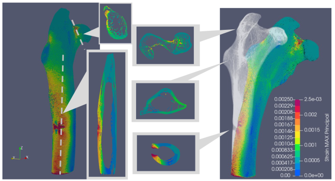 Simulated maximum principal strain in the rabbit femur in rainbow colors; five sections of the bone are highlighted in insets as well as the deformed configuration