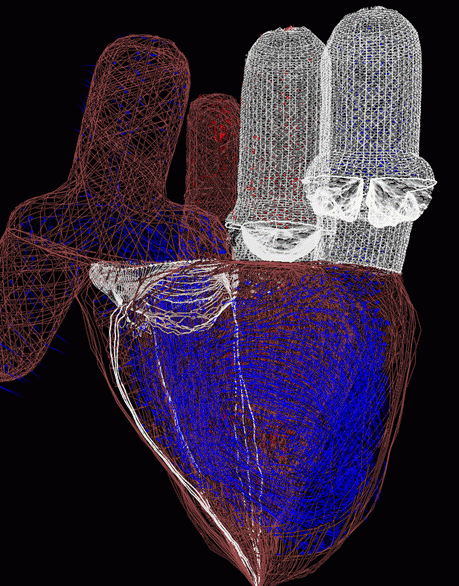 Figure 3. Diastolic filling of the right ventricle (blue markers) in a three-dimensional AMR simulation of cardiac fluid dynamics in the human heart.